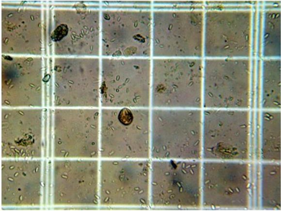 N. ceranae spores