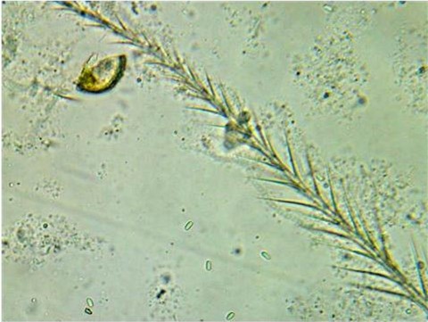 Low nosema infection Low nosema infection