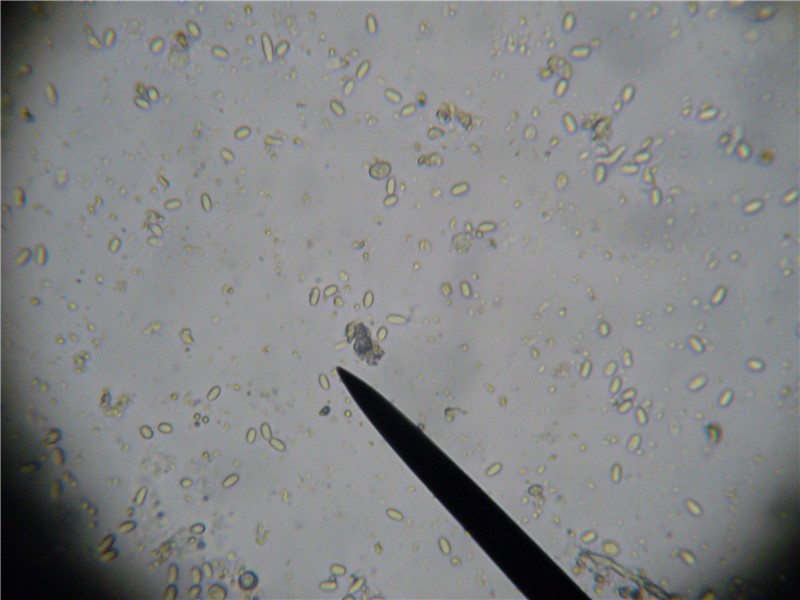 Gut sample