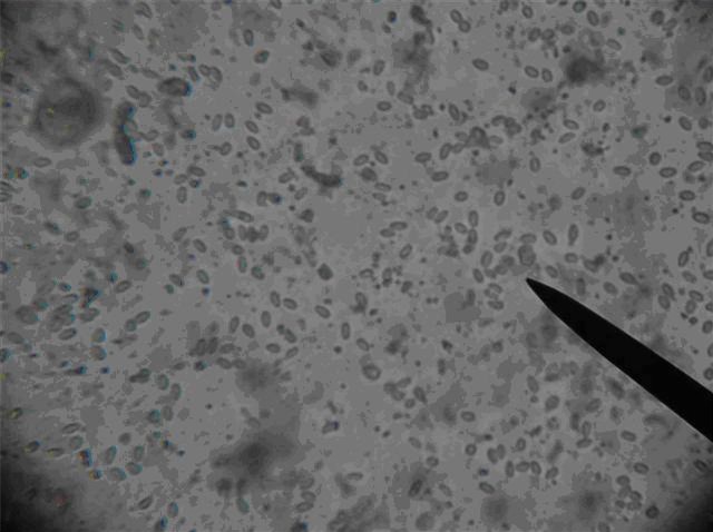 High nosema infection