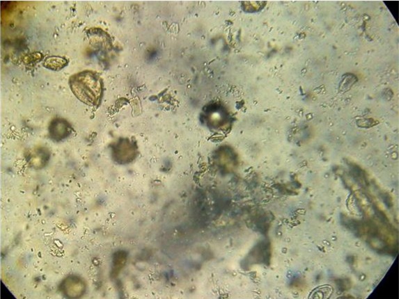 Comb surface at 400x