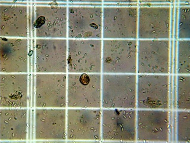 N. ceranae spores