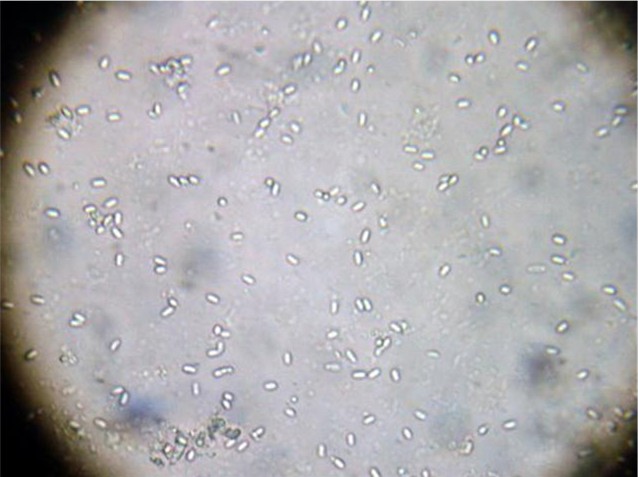 Nosema spores